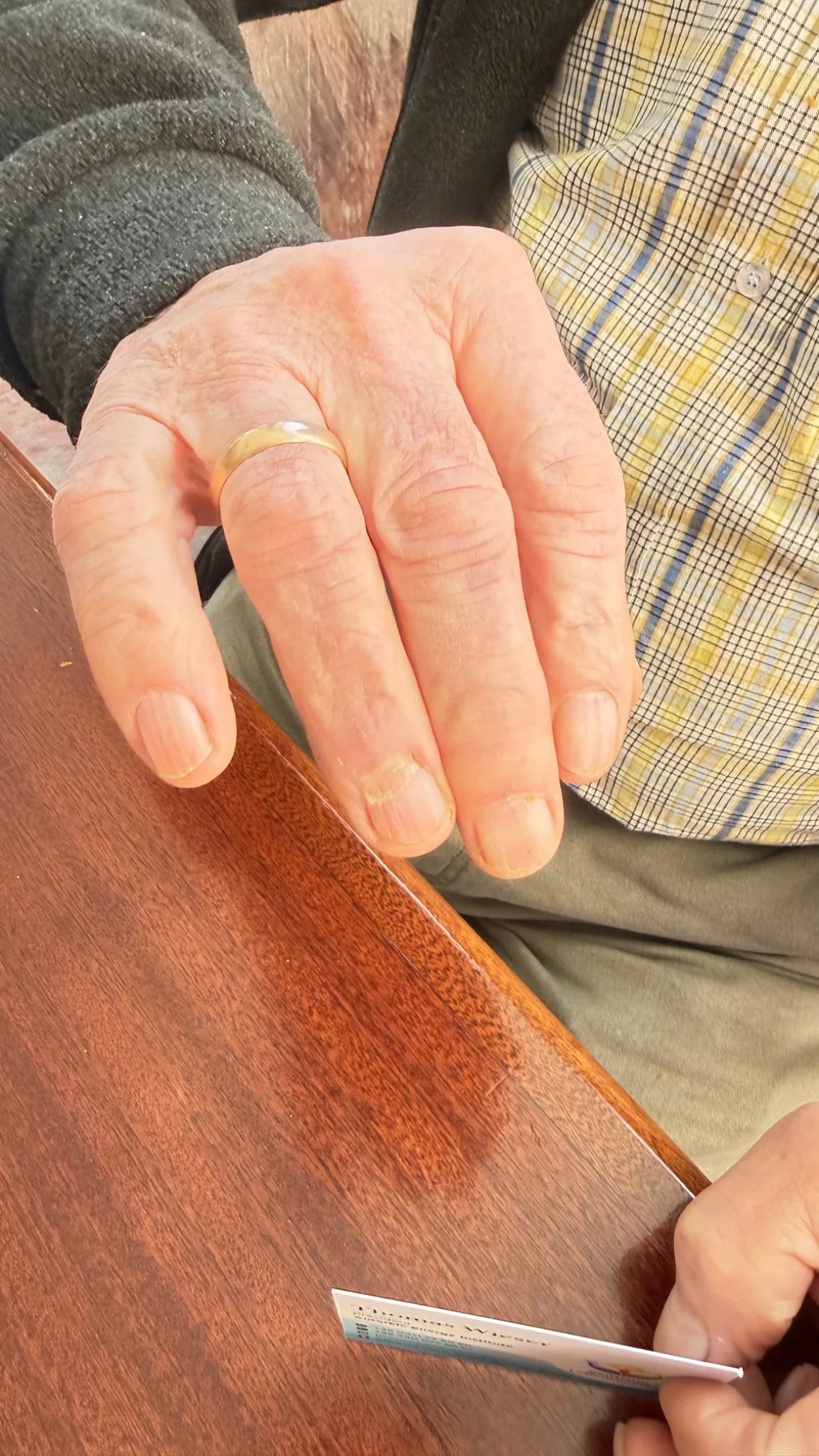 Hand von Luis Wieser mit dem Ringfinger aus der Familiengeschichte
